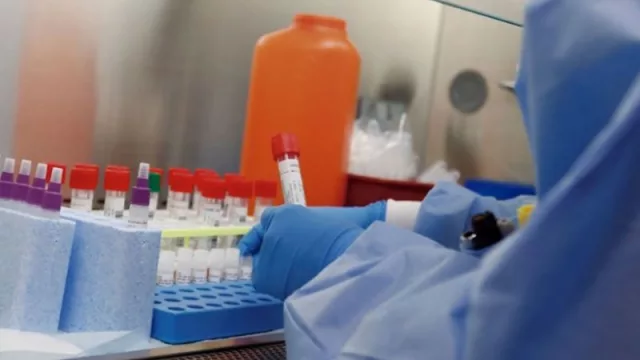 Según un especialista de Tucumán, la provincia está preparada para hacer los análisis de coronavirus 