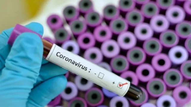 Vos frente al coronavirus