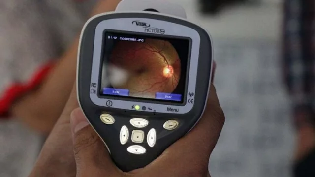 Con un novedoso proyecto tecnológico, en Tucumán refuerzan la detección de patologías oculares