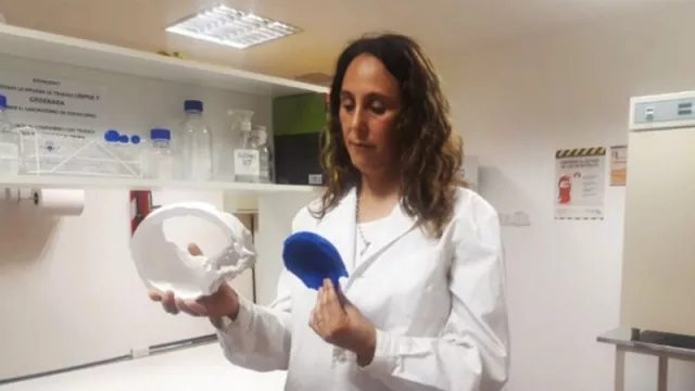 Orgullo tucumano: Huesos artificiales a medida, el novedoso proyecto que recorre el mundo