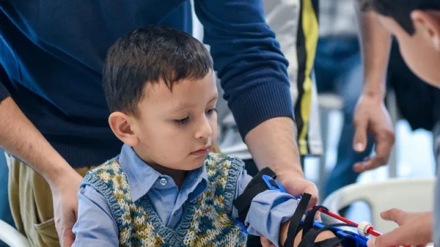 Macro presentó su primer “Manotón” (entregaron 20 prótesis mecánicas impresas en 3D)